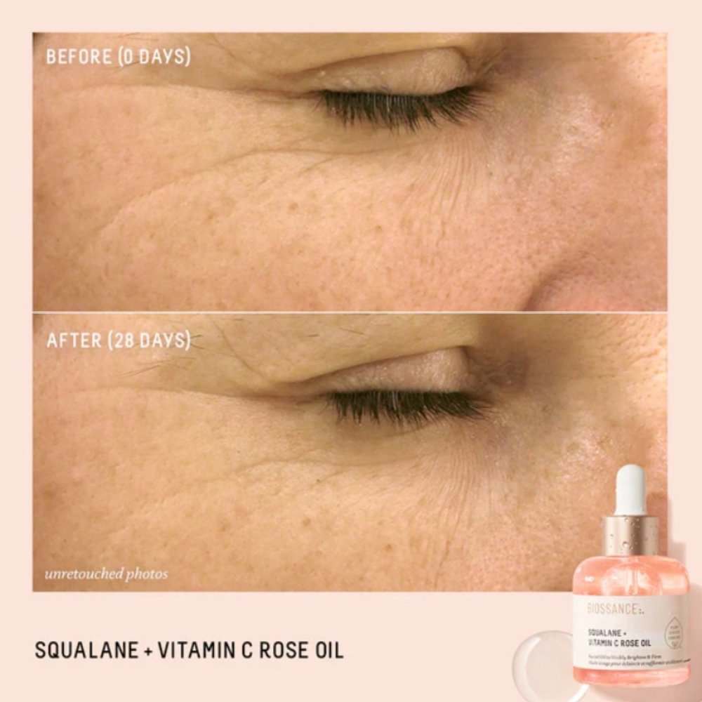 NIB Squalane + Vitamin C Rose oil - Biossance - Picture 6 of 14